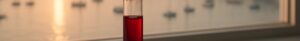 Thyroid blood test vial and stethoscope on Newport harbor windowsill at dawn